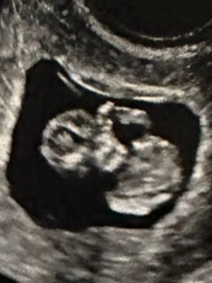 Cover of Crib Side Confessions: Never Ending Empty Cries